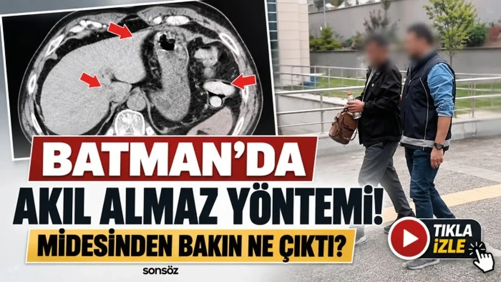 Batman’da akıl almaz yöntemi! Midesinden bakın ne çıktı?