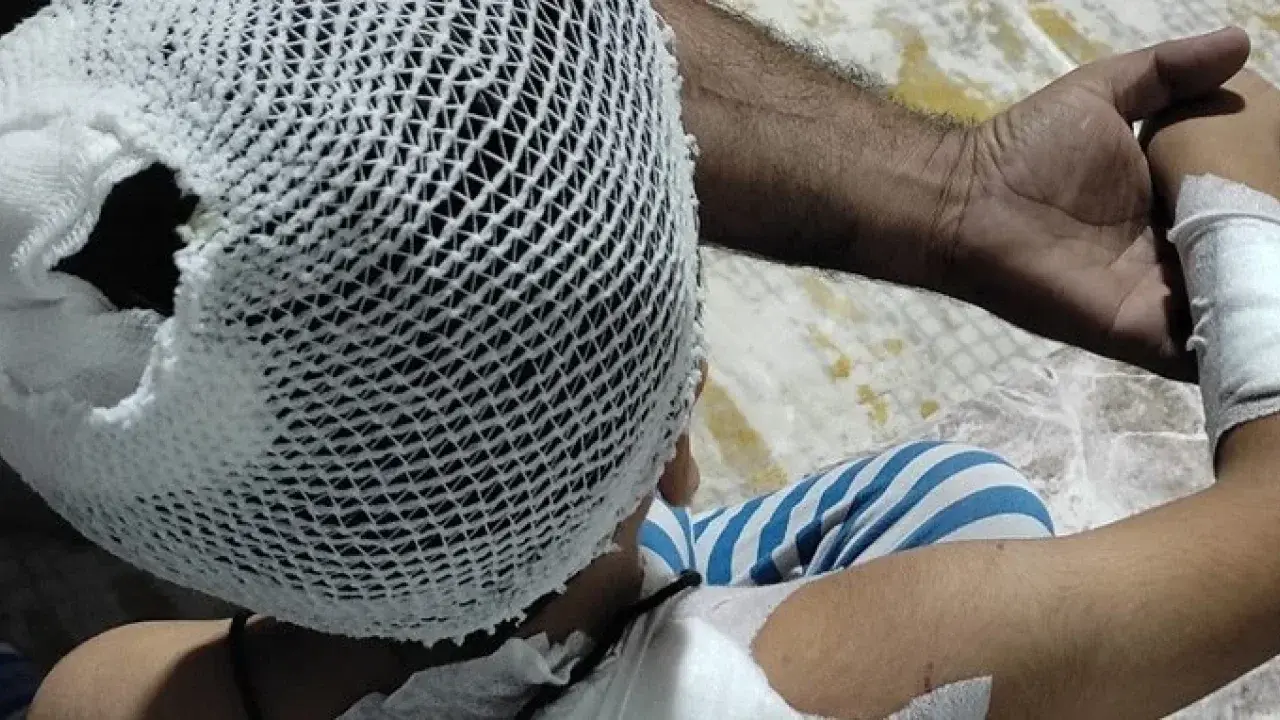 Sahipsiz köpeklerin saldırısına uğrayan çocuk yaralandı