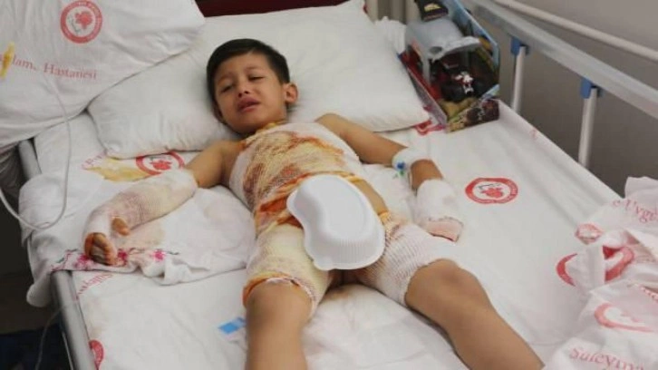 Ana sınıfı etkinliğinde feci olay! 6 yaşındaki Mehmet'in &uuml;zerine kaynar su d&ouml;k&uuml;ld&uuml;