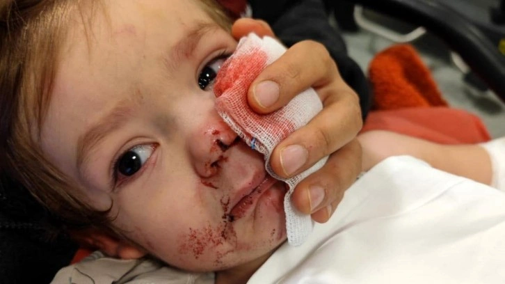 Ankara'da iki kardeşe saldıran pitbull ve sahibi yakalandı