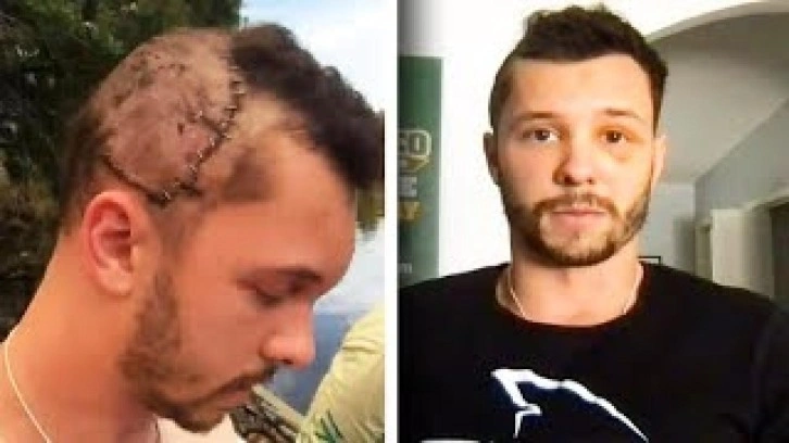 Ava giderken avlandı: Gen&ccedil; adam &ouml;l&uuml;mden d&ouml;nd&uuml;