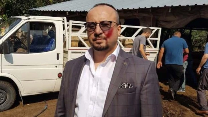 Avukatı ısırmanın cezası 2,5 yıldan 4 yıla &ccedil;ıkarıldı!