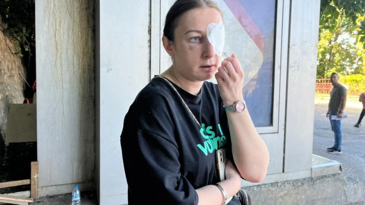 Bursa'da eski sevgilisi dehşeti: 9 defa y&uuml;z&uuml;ne kafa attı!