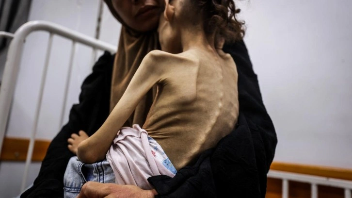 Gazze'de açlık krizi büyüyor! 9 yaşındaki Meryem 10 kiloya düştü