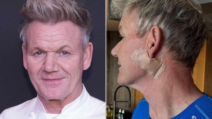Gordon Ramsay kansere yakalandı