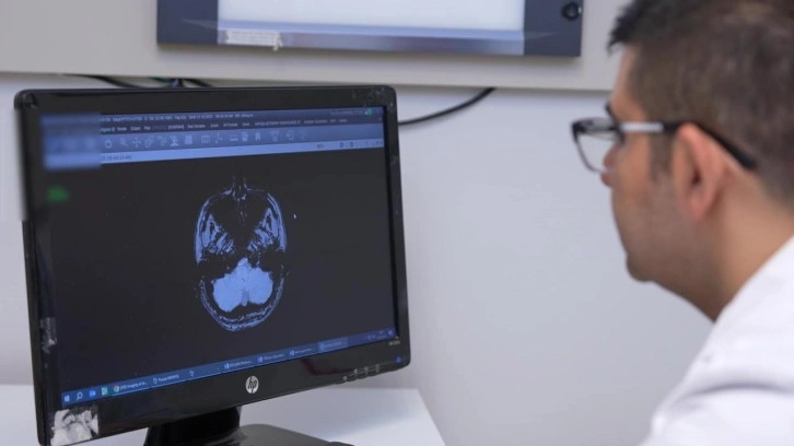 İnme, her yaşta görülebilir: İlk 24 saat hayati önem taşıyor