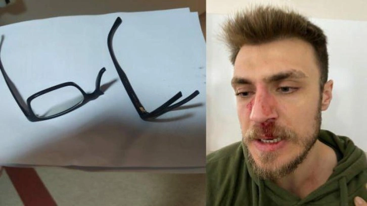 İzmir'de hasta yakınından doktora akıl almaz darp: Kafa travması ge&ccedil;irdi!