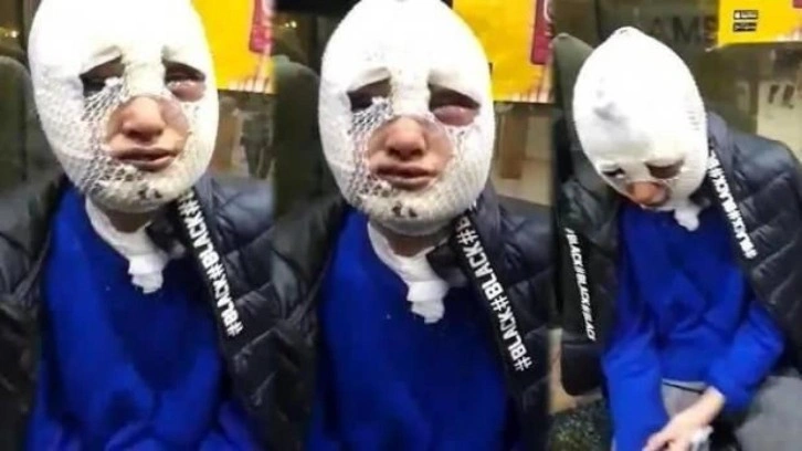 Kadına y&ouml;nelik şiddetin &ouml;nlenmesiyle ilgili kanun teklifi TBMM'de
