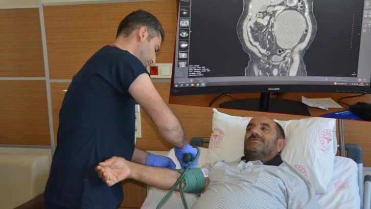 Karın ağrısı şikayetiyle gitti, doktorlar bile şoke oldu! Tam 23 santim...