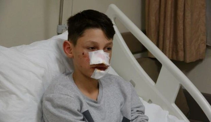 K&ouml;pek saldırısı ekmek almaya giden &ccedil;ocuğa dehşeti yaşattı