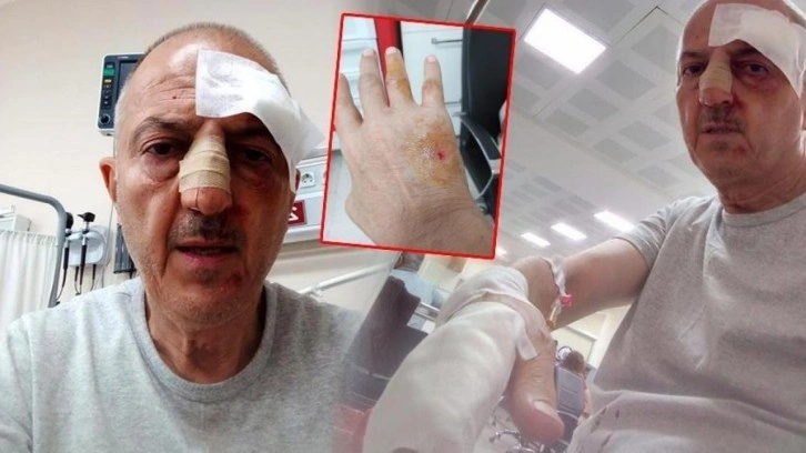 Önce icra yoluyla evinden tahliye edildi, ardından darp edildi