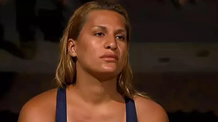 Survivor'dan sonra bıçak altına yatmıştı! Almeda'nın son hali hayrete düşürdü