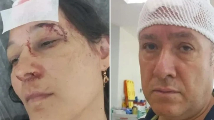 Tatilde kabusu yaşadılar! Demir sopalarla dövülüp hastanelik oldular
