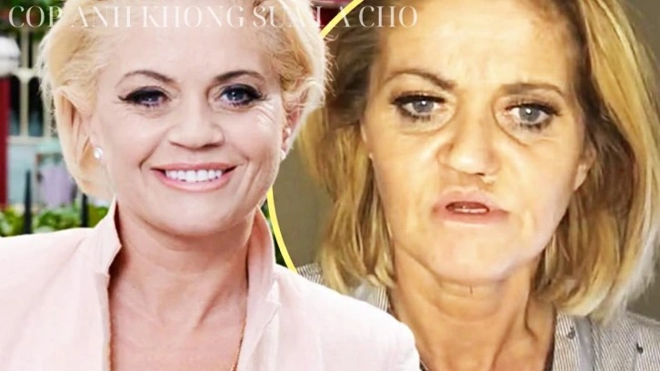 Uyuşturucu &uuml;nl&uuml; yıldızın y&uuml;z&uuml;n&uuml; mahvetti