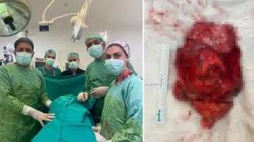 2.5 milyonda bir görülüyor, tam 1,1 kg!