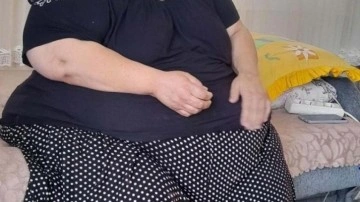 200 kiloya ulaşan fil hastası kadın, 7 yıldır evden &ccedil;ıkamıyor