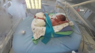 495 gramlık premat&uuml;re bebeğe k&ouml;k h&uuml;cre nakli: D&uuml;nyada ve T&uuml;rkiye'de sayılı nakil!