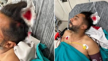 Adana'da döner ustası yorgun mermiyle başına isabet aldı