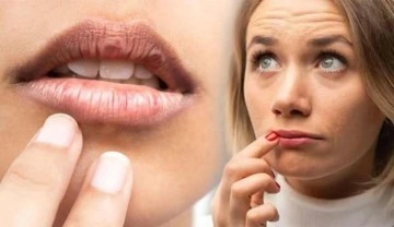 Ağız kuruluğuna dikkat! Bazı hastalıkların habercisi olabilir