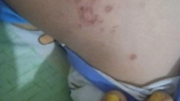 Antalya'da korkunç şüphe: Denizden çıkan çocuk bir anda fenalaştı!