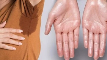 Aşırı terleme neden olur? Aşırı terleme nasıl ge&ccedil;er, hangi hastalığın belirtisi?