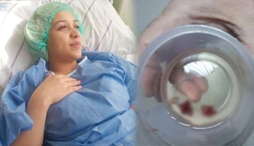 Baş ağrısı şikayetiyle hastaneye başvuran gen&ccedil; kızın burnundan taş &ccedil;ıktı