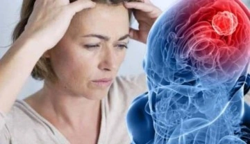 Beyin t&uuml;m&ouml;r&uuml;n&uuml;n belirtileri: Hepsi &ouml;ld&uuml;r&uuml;c&uuml; değil