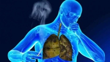 Bilim Kurulu &Uuml;yesi &Ouml;zl&uuml; uyardı: &Ouml;ks&uuml;r&uuml;k ve balgam alarmdır