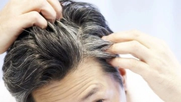 Bu gıdalar sa&ccedil;larınıza aklar d&uuml;ş&uuml;r&uuml;yor! Erkenden yaşlı g&ouml;r&uuml;nmemek i&ccedil;in bunlardan uzak durun