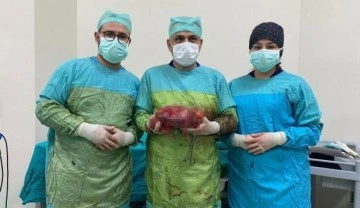 Denizli'de 71 yaşındaki adam karın ağrısıyla gitti, i&ccedil;i taş dolu b&ouml;breği alındı