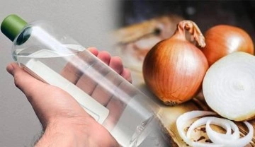 Epilepsi n&ouml;beti ge&ccedil;irene soğan ve kolonyanın faydası yok!