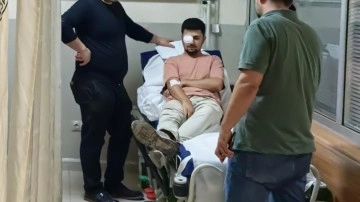 Fabrikada feci kaza: Gözüne çivi saplandı!