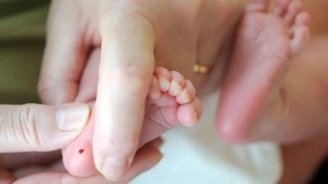 Fenilketon&uuml;ri hastalığı nedir, belirtileri nelerdir? Bebeklerde fenilketon&uuml;ri hastalığı tedavisi