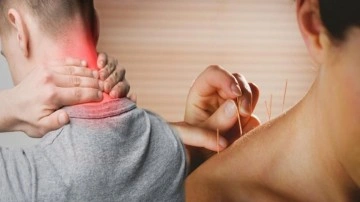 Fibromiyalji hastalarına mucize tedavi! Kuru iğne tedavisi ağrı noktaları&hellip;