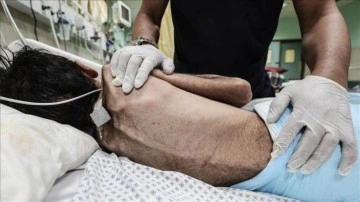 Gazze'de açlıktan ölenlerin sayısı 404'e yükseldi