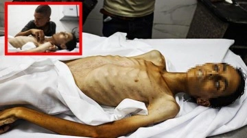 Gazze'de açlıktan şehit olanların sayısı 162'ye çıktı