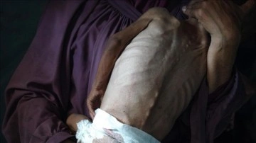 Gazze'de son 1 günde 1'i çocuk 6 kişi daha açlıktan şehit oldu
