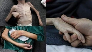 Gazze'de tam abluka! Uluslararası vicdan rafa kalktı!