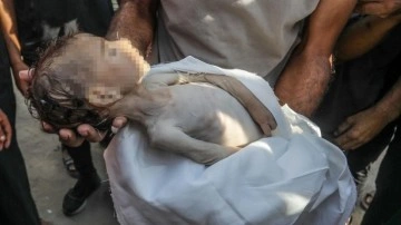Gazze felaket boyutunda açlıkla karşı karşıya: Çocuklar açlıktan eriyor