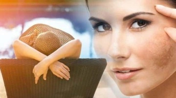 G&uuml;neş lekeleri nasıl &ccedil;ıkar? Y&uuml;zdeki g&uuml;neş lekelerine iyi gelen 5 doğal maske ve k&uuml;r...
