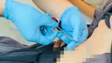 Halsizlik şikayetiyle doktora gitti, karnına yapışanı öğrenince şoke oldu