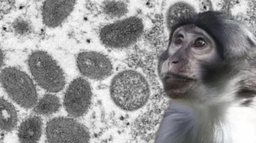 'Hastalıklı maymunlar' alarma geçirdi! ABD'de tuhaf olay!