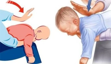 'Heimlich manevrası' &ouml;zellikle 1 yaş altı &ccedil;ocukların hayatını kurtarıyor