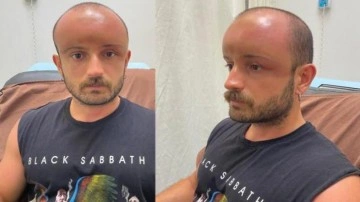 İki g&uuml;n plaja gitti, hayatının şokunu yaşadı! Milyonda bir g&ouml;r&uuml;l&uuml;yor