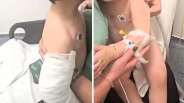 iki yaşındaki bebeği öldüresiye dövdüler