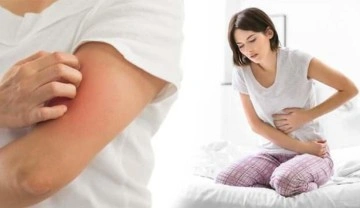 İla&ccedil; alerjisinin belirtileri: Ciltte d&ouml;k&uuml;nt&uuml;, nefes darlığı, karın ağrısı...