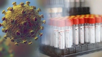 İnfluenza nedir, belirtileri nelerdir? Domuz gribi ne kadar s&uuml;rer?