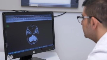 İnme, her yaşta görülebilir: İlk 24 saat hayati önem taşıyor