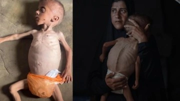 İsrail'in açlık silahı... Gazze'de 40 binden fazla bebek ölüm riskiyle karşı karşıya