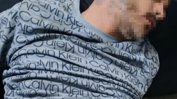 KADES ihbarına giden polisi bıçaklayan şahıs vurularak yakalandı